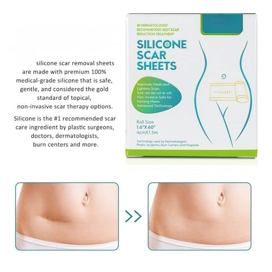 Silicone Scar Tape