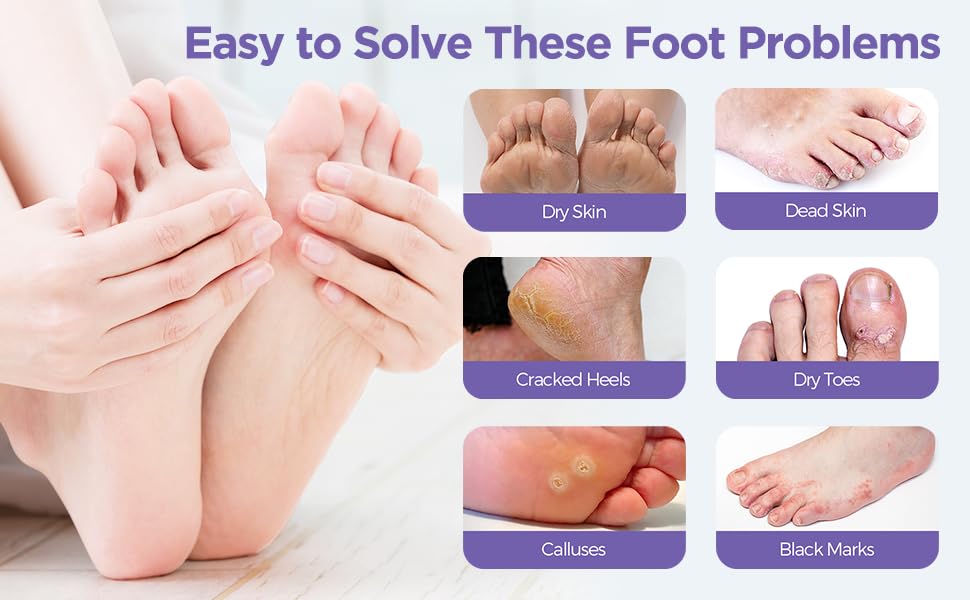 Foot Peel Mask